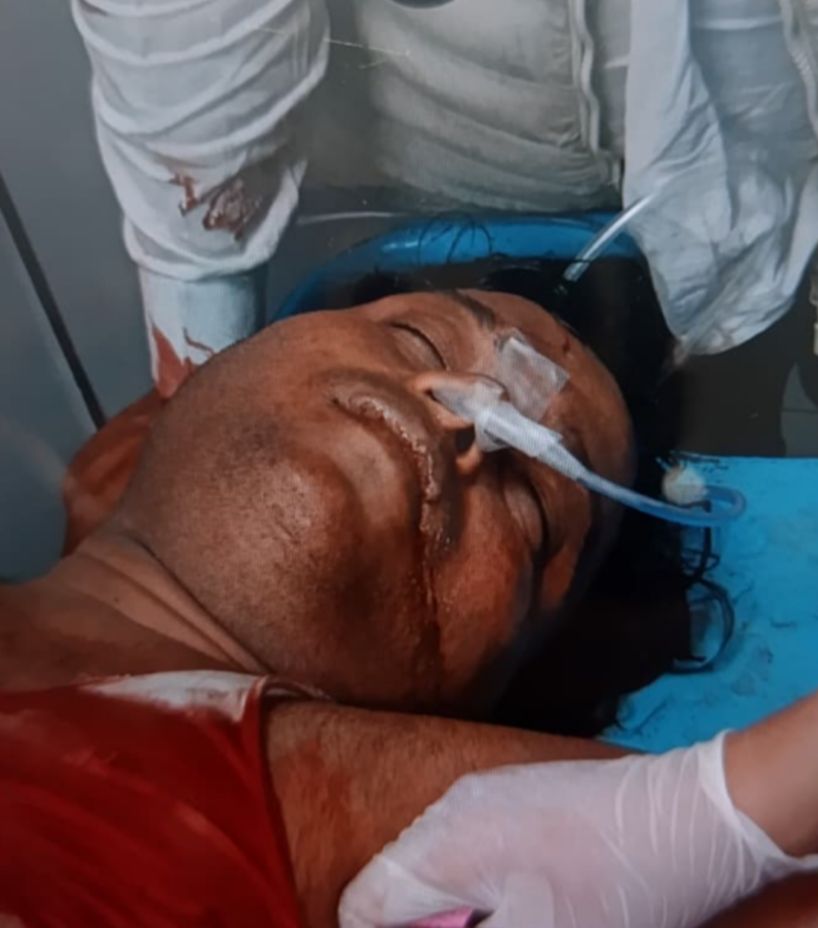 bjp-leader-attacked-over-old-rivalry-condition-cri