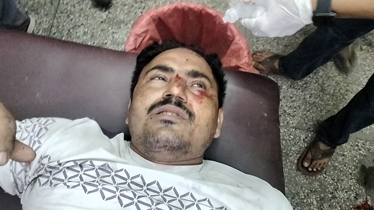 up-auraiya-accident-4-injured